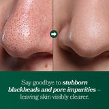 [Omitted] Fresh Lime Pore Clearing Deep Cleansing Oil 200ml