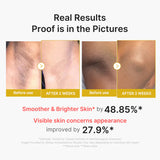 [Medicube] Kojic Acid Turmeric Body Peel Shot 280ml