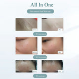 Laser Hair Removal Device - Painless Hair Removal Tool